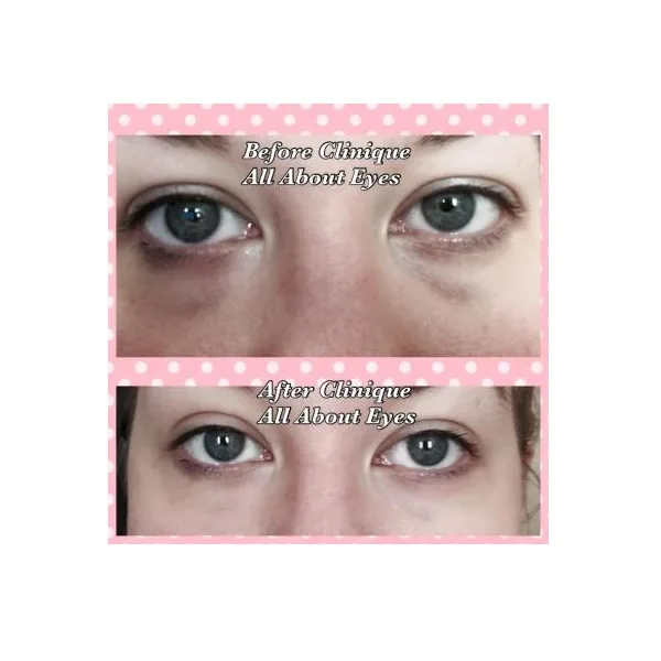 دور چشم کلینیک Clinique مدل آل ابوت آیز all about eyes حجم 15 میل، ضد چروک پف و تیرگی
